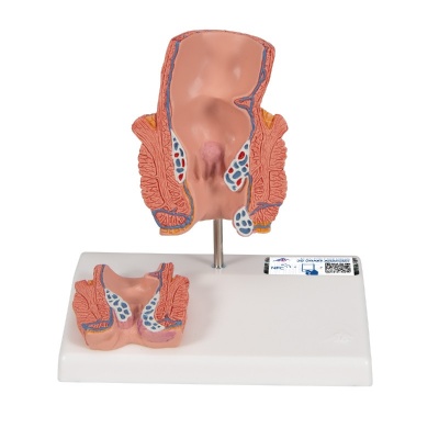 3B Scientific Frontal-Section Rectum Model with Haemorrhoids